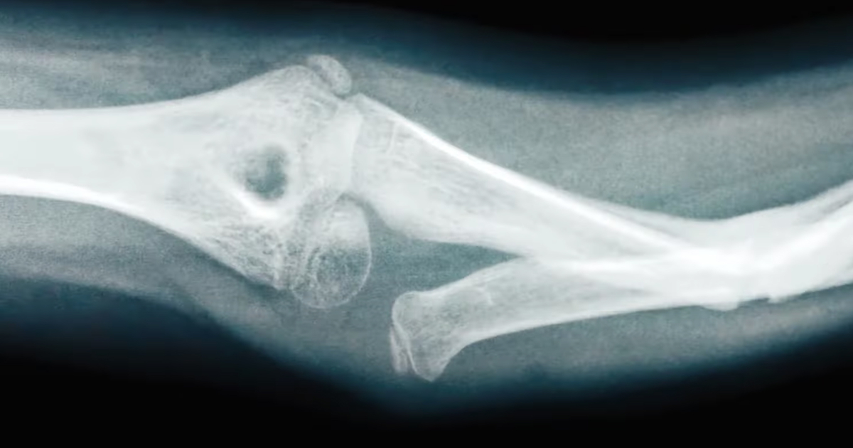 New commercials Bodyarmor, Apple Olivia Rodrigo, Visible Jason Alexander, Experian Travis Kelce